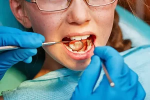 Cómo se diagnostican los tipos de caries dentales hoy en día